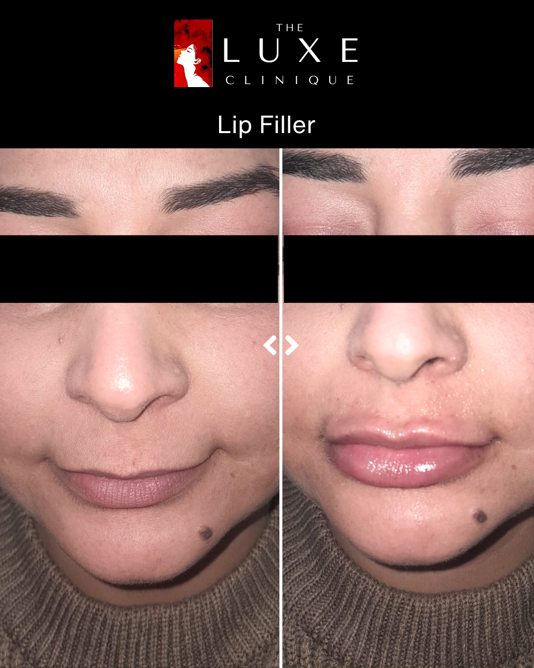 Facial Treatment 3